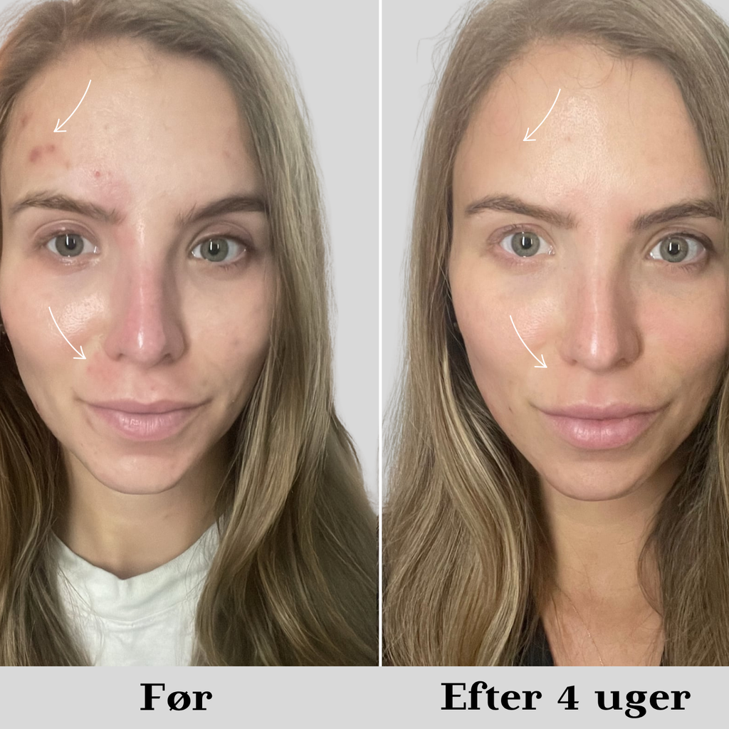 AYA 6-i-1 SKINCARE EXPERT PRO