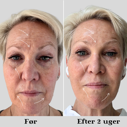 AYA Skincare Expert Pro
