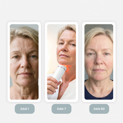 AYA Skincare Expert Pro